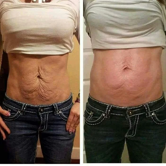 Before and after with XeiuC Collagen Oil
